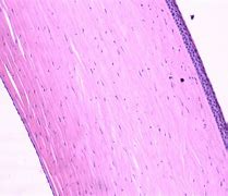 Image result for Histology of the Cornea