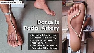 Image result for Arteria Dorsalis Pedis