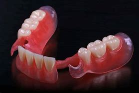 Image result for Valplast Partial One Tooth