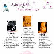 Image result for USG 4D 2-3 Minggu