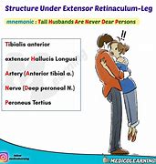 Image result for Flexor Retinaculum Hand Contents Mnemonic