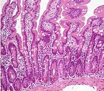 Image result for Duodenal Mucosa