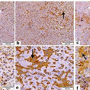 Image result for CD4 Liver