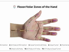 Image result for Volar Aspect Finger