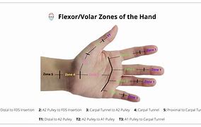 Image result for Volar and Dorsal Hand