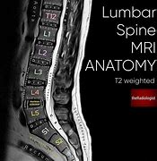 Image result for Lumbar and Sacral Spine