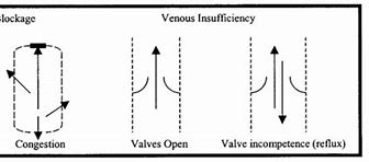 Image result for Nonphasic Venous Flow