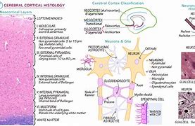 Image result for Brain Tissue Histology