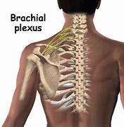 Image result for Brachial Plexus Fall Injury