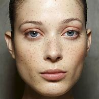 Image result for Interesting Faces Freckles