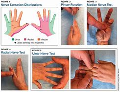 Image result for Wrist Laceration