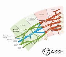 Image result for Brachial Plexus Roots