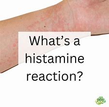 Image result for Histamine Reaction