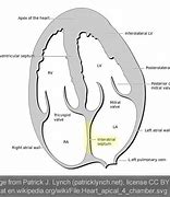 Image result for Interatrial Septum Formation