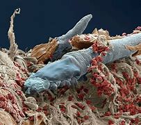 Image result for Face Mites in Pores