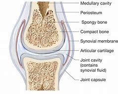 Image result for Inflammed Synovial Tissue