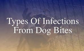 Image result for Tetanus From Dog Bite