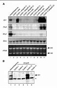 Image result for Shh Pathway Medulloblastoma