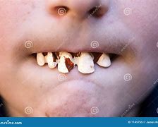 Image result for Halloween Pointy Teeth