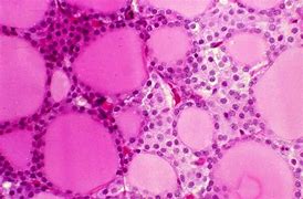 Image result for Parafollicular Cells Histology