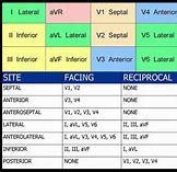 Image result for EMS Cheat Sheet