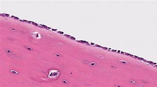 Image result for Osteoblasts in Bone