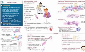 Image result for Myocarditis Treatment