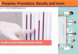 Image result for ESR Procedure