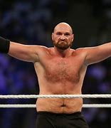 Image result for Tyson Fury Jawline