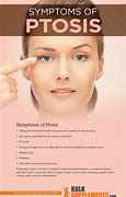 Image result for Ptosis Nerve Damage