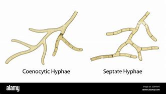 Image result for Fungal Hyphae and Spores