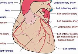 Image result for Atrioventricular Coronary Sulcus