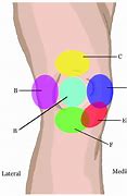 Image result for Left Side Knee Pain