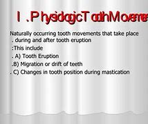 Image result for Propel Tooth Movement