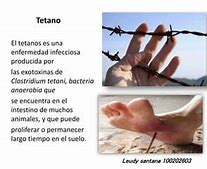 Image result for Tetano Muscolare