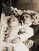 Image result for Post-Mortem Mother and Child