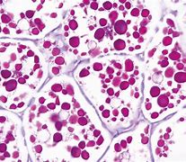 Image result for Pathology Images