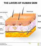 Image result for Skin Atrophy Diagram