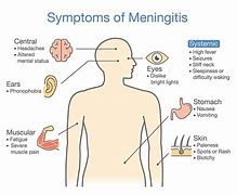 Image result for Meningitis Signs