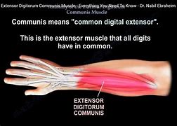 Image result for Extensor Digitorum Communis