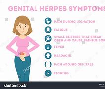 Image result for Herpes Genitalis