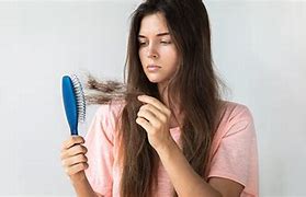 Image result for Iron Hair Loss