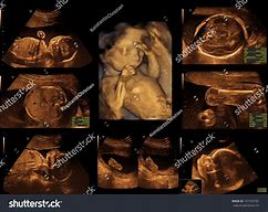 Image result for Baby Ultrasound Photo