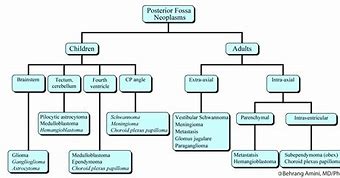 Image result for Extra-Axial Posterior Fossa Mass