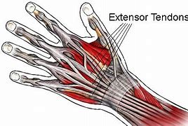 Image result for Extensor Tendons Dorsal Hand