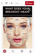 Image result for Bad Break Out Face