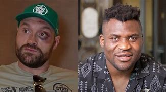 Image result for Tyson Fury Eye Injury