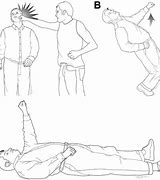 Image result for Fencing Posture Concussion