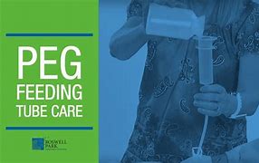 Image result for Peg Patient