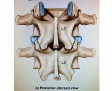 Image result for Dorsal Spine View